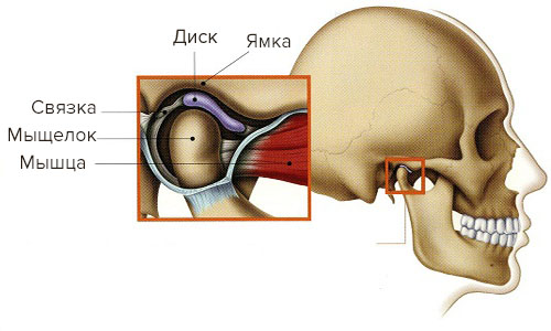 Артрит внутри челюстного сустава 146