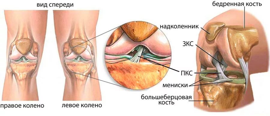 Артроскопия передней крестообразной связки коленного сустава восстановление 139