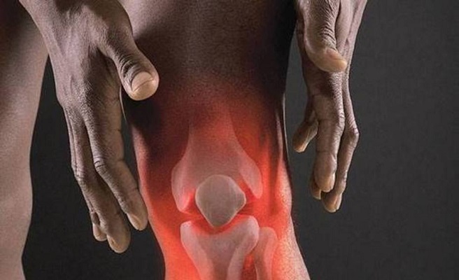 Артроз коленного сустава лечение в домашних условиях 145