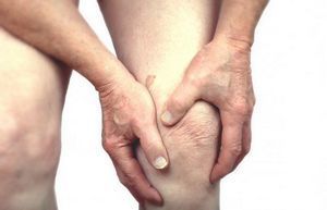 Артрозный артрит коленного сустава 91