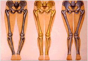 Биомеханика коленного сустава человека 63