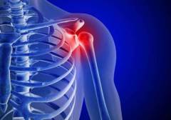 Боль плечевого сустава какой врач лечит 189