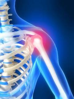 Боль плечевого сустава какой врач лечит 4