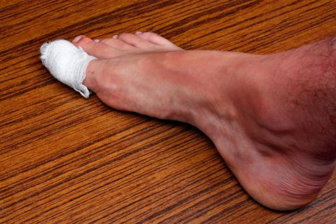 Боль в суставах больших пальцев ног лечение 84