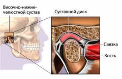 Болит сустав челюсти при открывании рта 111