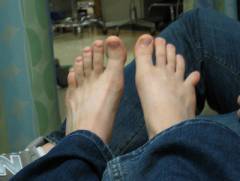 Болят суставы больших пальцев ног лечение 83