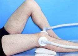 Бурсит синовит коленного сустава симптомы и лечение 61