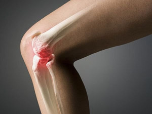 Чем лечить деформирующий остеоартроз коленного сустава 27