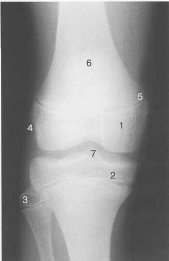 Гиалиновый хрящ коленного сустава норма толщина 159