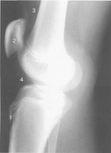 Гиалиновый хрящ коленного сустава норма толщина 18