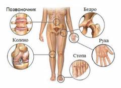 Инфекции вызывающие заболевания суставов 114