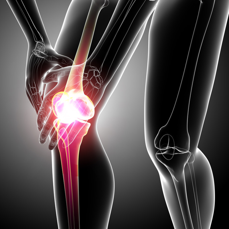 Как лечить дегенеративные изменения менисков коленного сустава? 63