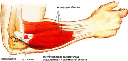 Как называется мышца сгибающая руку в локтевом суставе