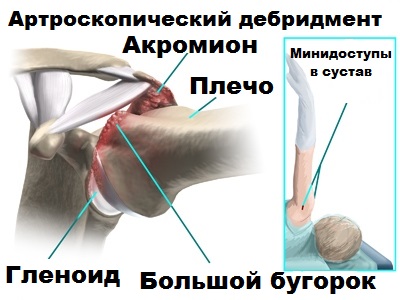 Клиника плечевого сустава 168