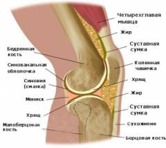 Лечебно диагностическая артроскопия коленного сустава 68