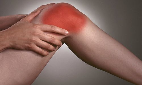 Лечение остеоартроза коленного сустава народными средствами 3