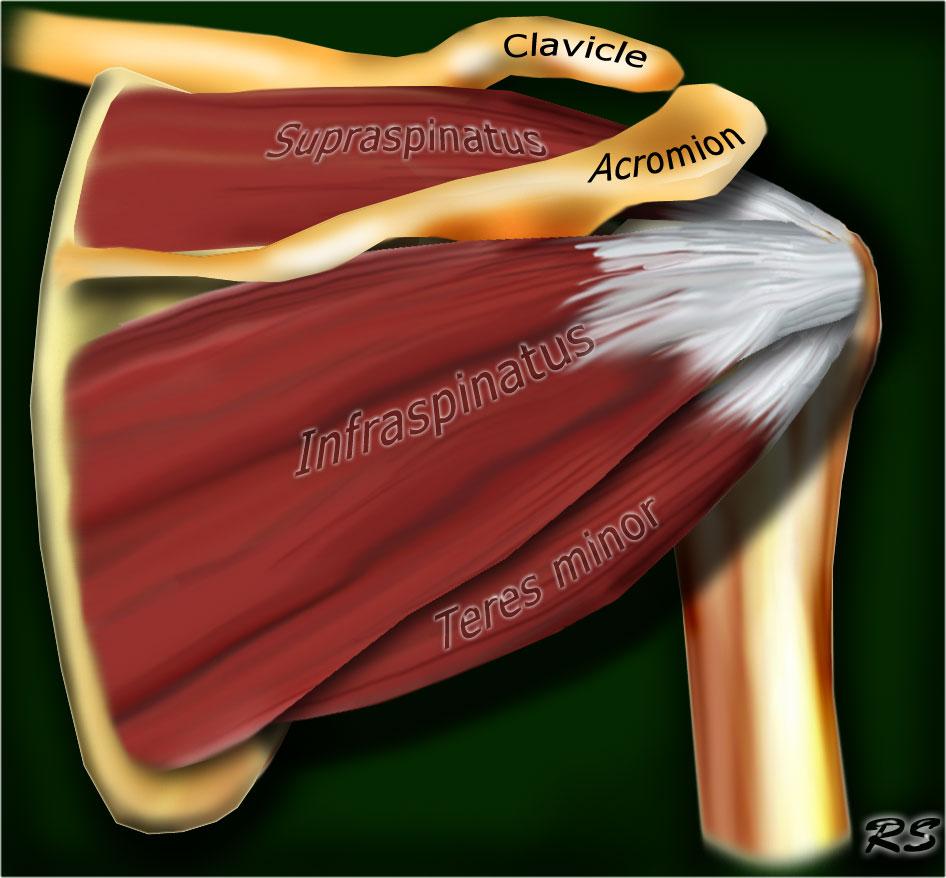 Надостная мышца плечевого сустава 73