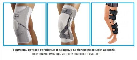 Наколенники ортопедические при артрозе коленного сустава 135