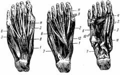 Нарост на суставе большого пальца ноги 3