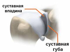 Особенности строения сустава делают его прочным 13