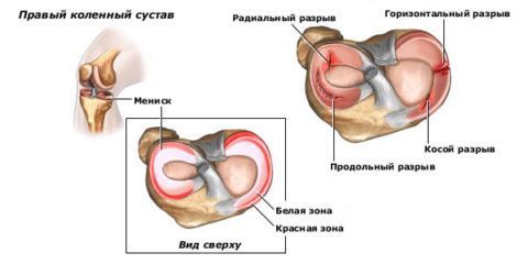 Особенности строения сустава делают его прочным 13