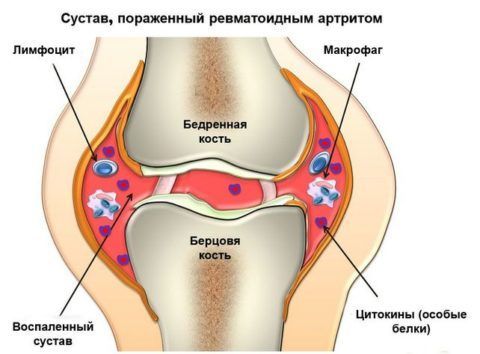 Особенности строения сустава делают его прочным 49