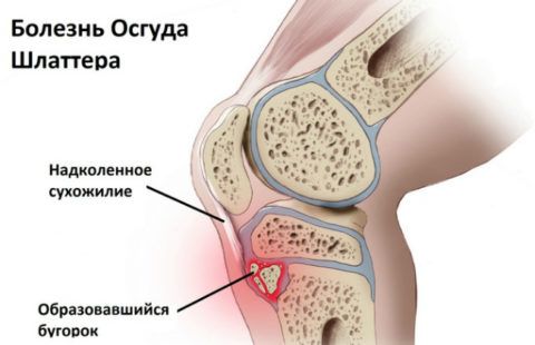 Особенности строения сустава делают его прочным 134