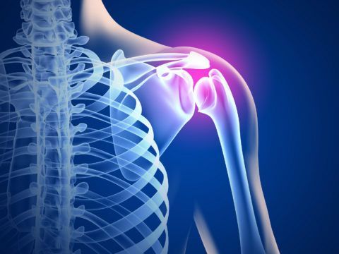 Остеоартроз плечевого сустава симптомы и лечение 183