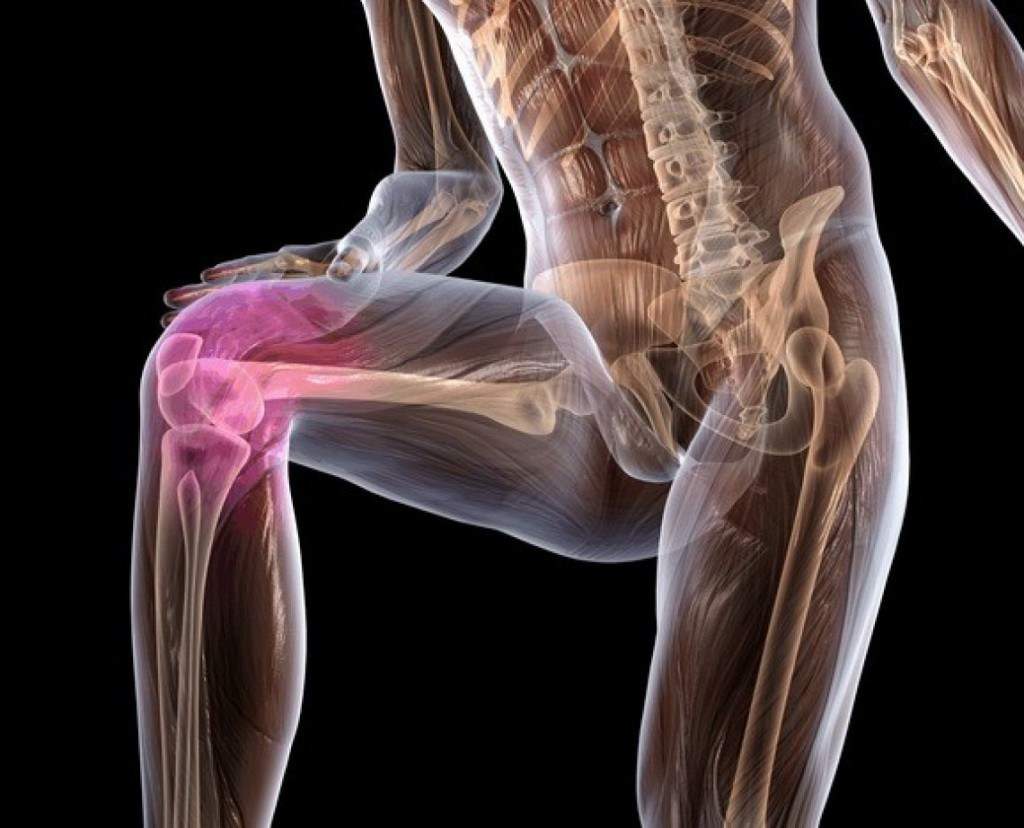 Остеохондроз коленного сустава народное лечение 17
