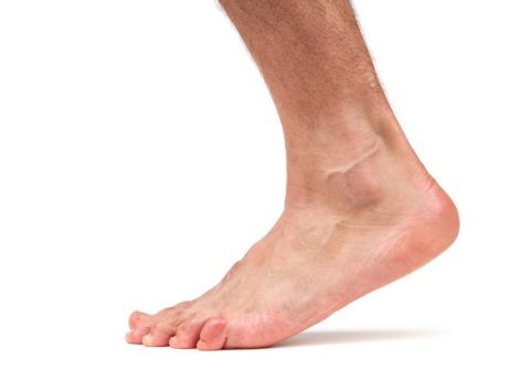 Перелом голеностопного сустава ноги 48