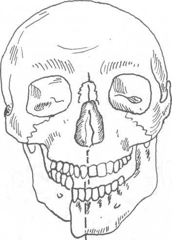 Перелом сустава челюсти 91