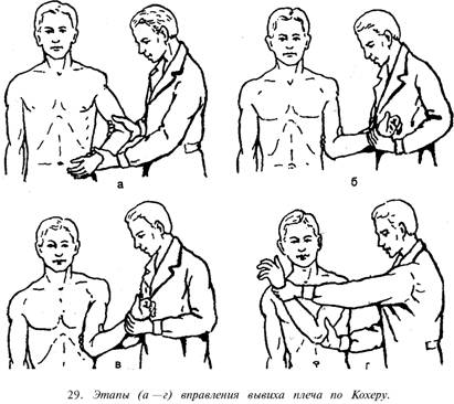 Плечевой сустав травматология 194