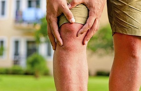 Почему возникает артроз коленного сустава? 178