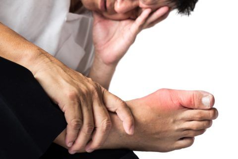 Подагра сустава большого пальца ноги лечение 128