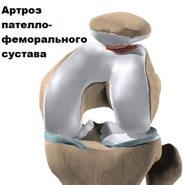 Подвижность коленного сустава 167