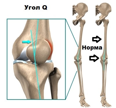 Подвижность коленного сустава 125