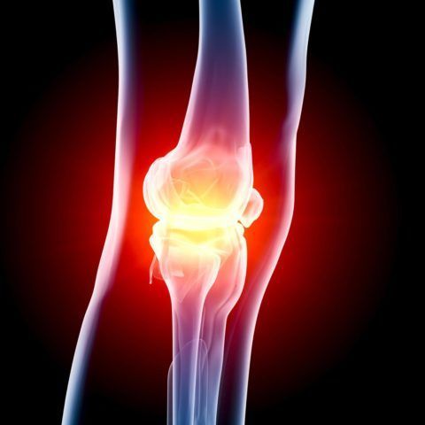 Признаки артрита коленного сустава 187