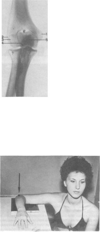 Рентгеновские снимки плечевого сустава 113