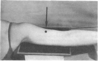 Рентгеновские снимки плечевого сустава 29