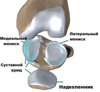Резекция внутреннего мениска коленного сустава 188