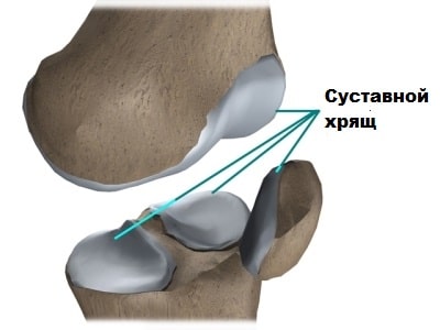 Резекция внутреннего мениска коленного сустава 172