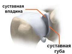 Санационная диагностическая артроскопия плечевого сустава 127