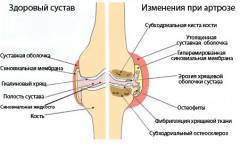 Щель голеностопного сустава 2