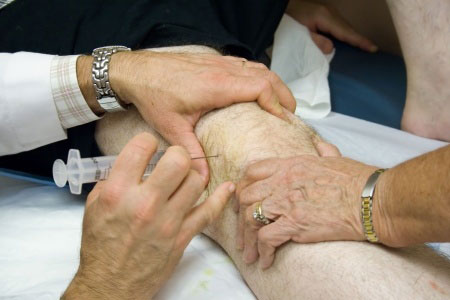 Синусит коленного сустава лечение 139