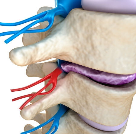 Субхондральный склероз суставных поверхностей плечевого сустава