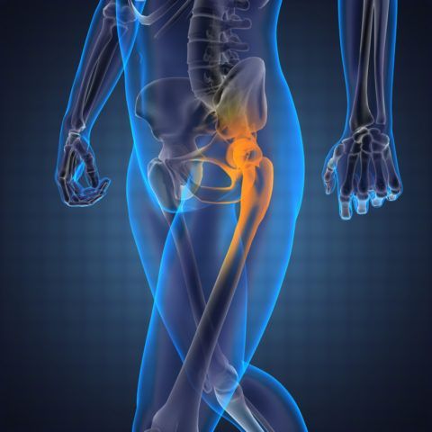 Тазобедренный сустав болит при ходьбе лечение 2