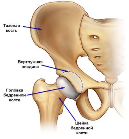 Тотальный протез тазобедренного сустава 59