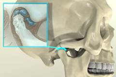 Височно нижнечелюстной сустав лечение народными средствами 51