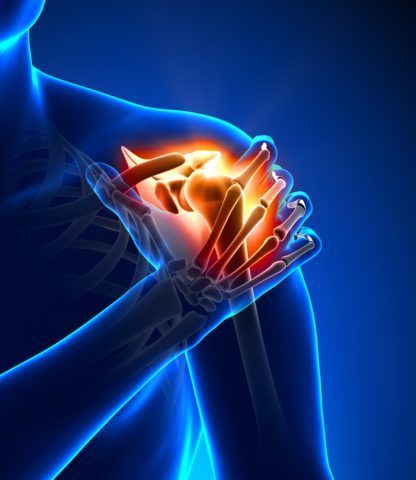 Воспаление сухожилий плечевого сустава лечение 65